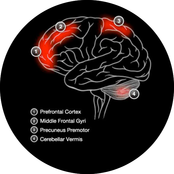 Brain Activity Verbal Memory