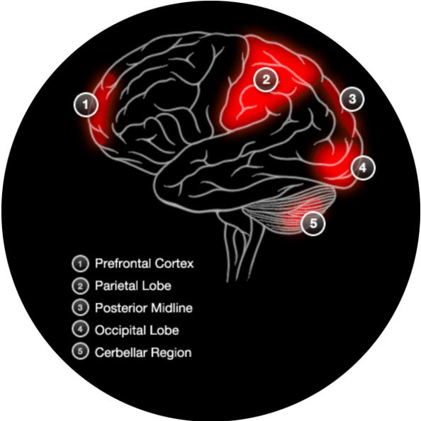 Brain Activity With Non Verbal Memory
