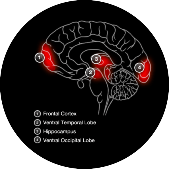 Brain Activity Recognising Faces